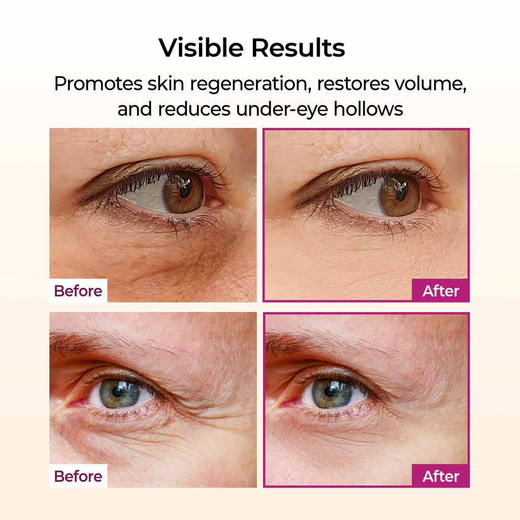 Calcium Volume Multi Balm before and after around the eyes