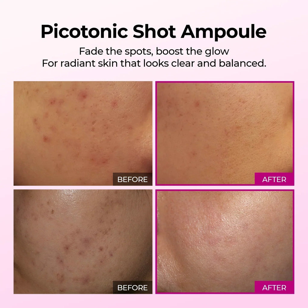 Picotonic Shot Ampoule before and after — fading dark spots