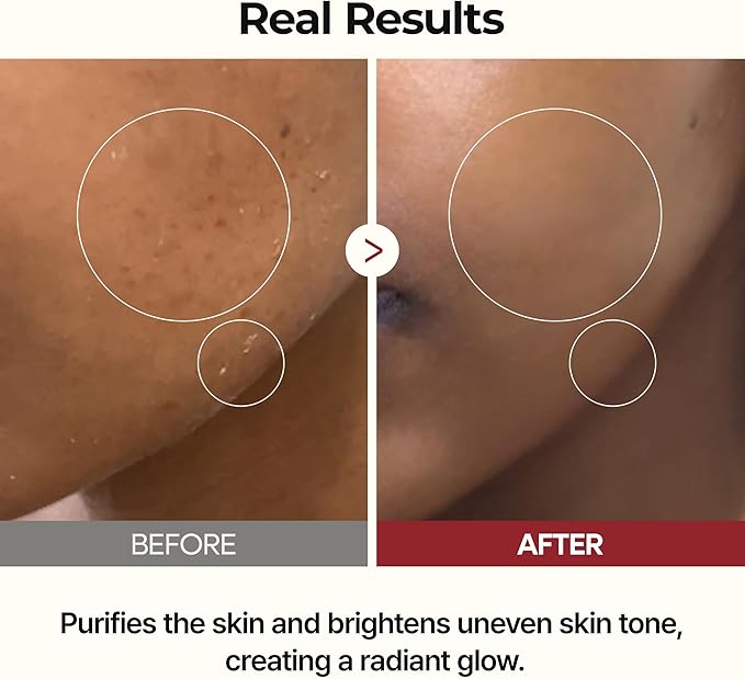 Rice Peel Ampoule