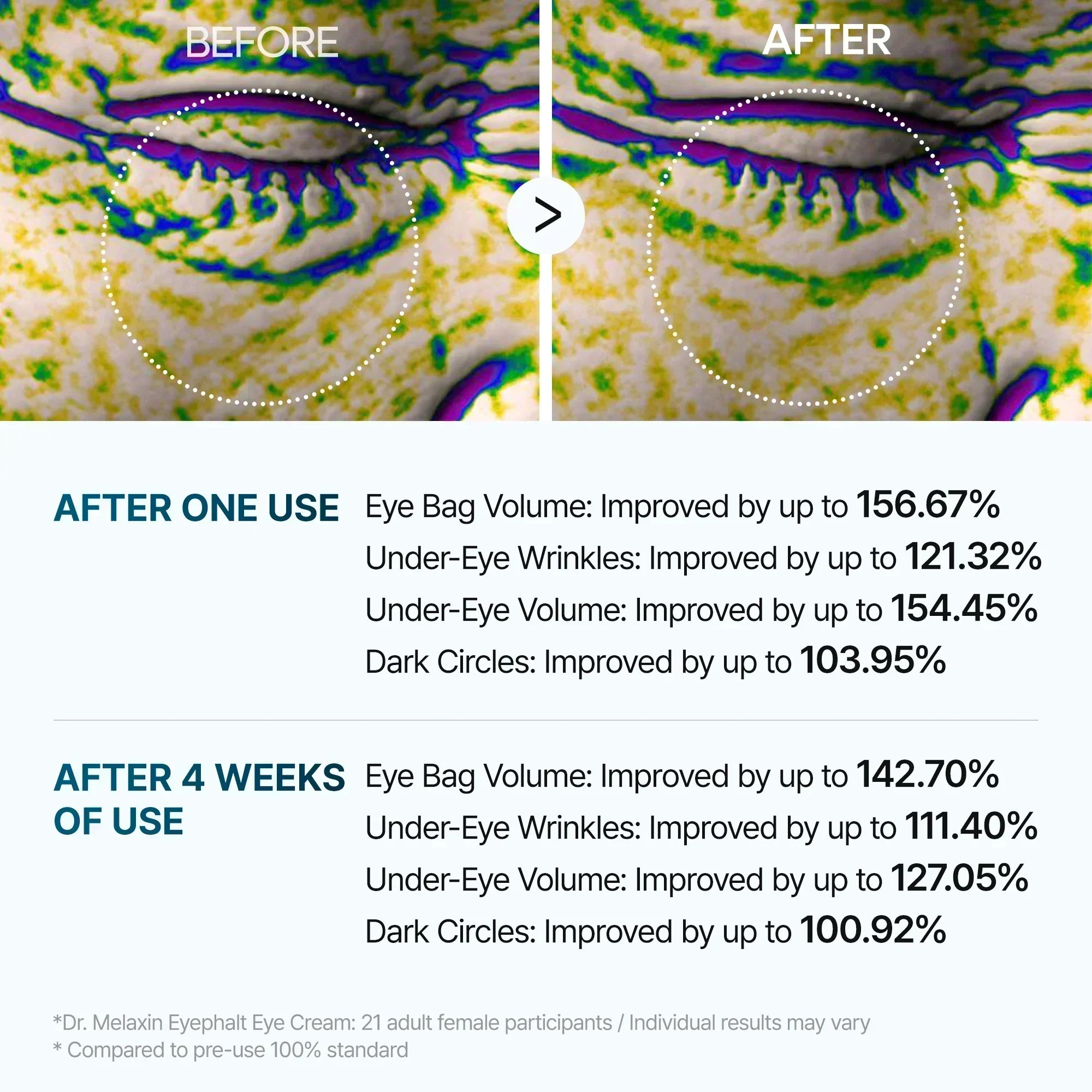 Eyephalt results after one use and after four weeks