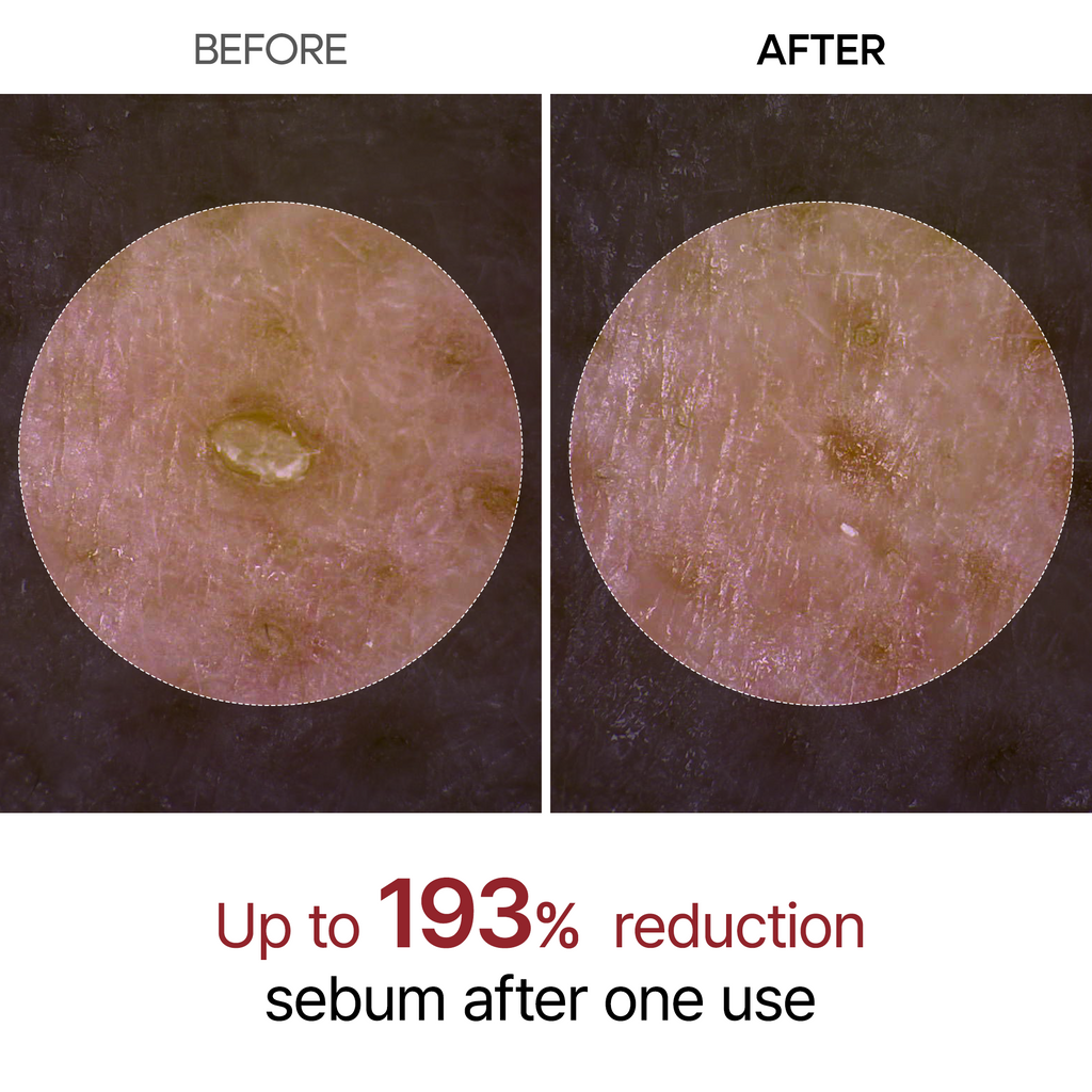 Black Rice Ampoule — up to 193% sebum reduction after one use