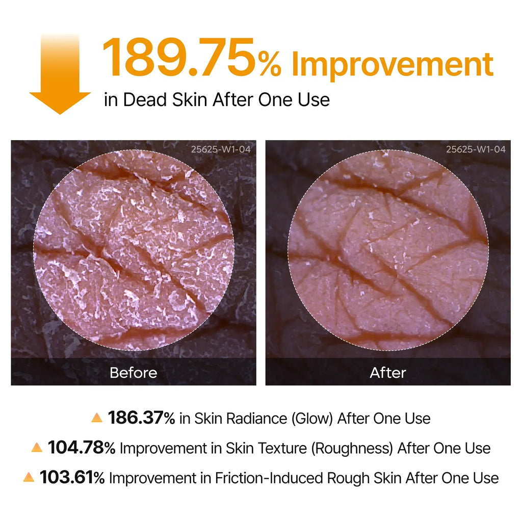 Peel Shot Complete Care Set