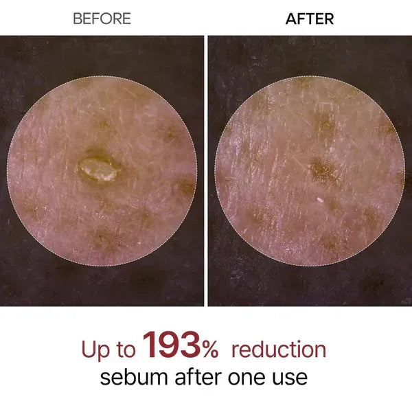 Rice Peel Ampoule